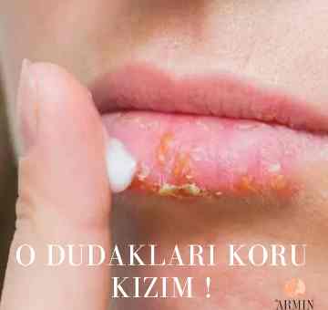 O Dudakları Koru Kızım!